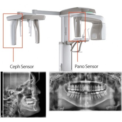 Аппарат рентгеновский дентальный цифровой панорамный Smart Plus с функцией компьютерного томографа и цефалостатом с принадлежностями